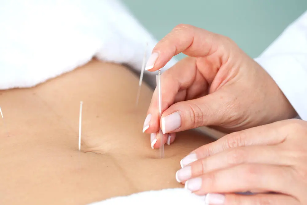 can acupuncture weight loss