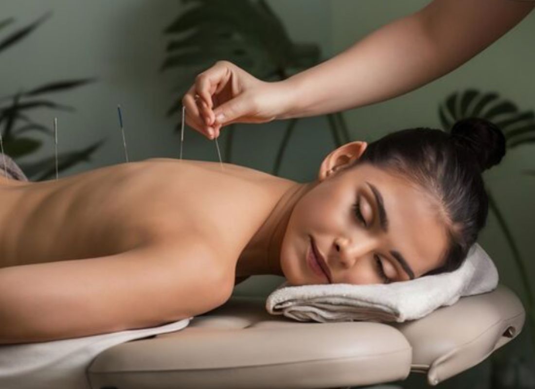 Happens During Your First Acupuncture Session