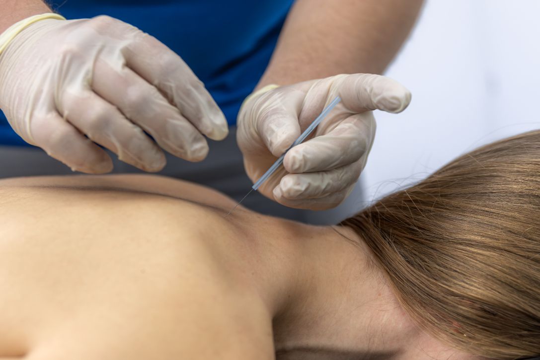 acupuncture for chronic pain NYC